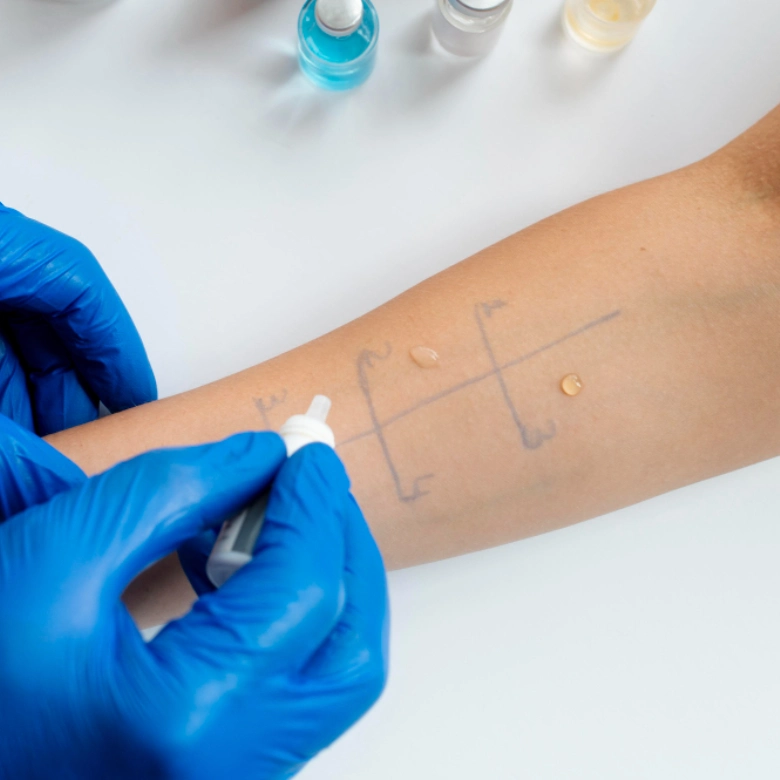 Why Should You Get Your Child Tested for Allergies?